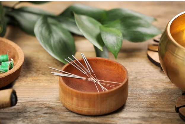 Acupuncture at Aurora Village Therapy and Wellness Centre